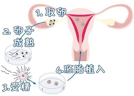 供卵代怀公司